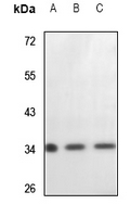 1 - Anti-Cytochrome c1 Antibody AP60447