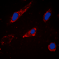 3 - Anti-Cytochrome P450 2C19 Antibody AP60448