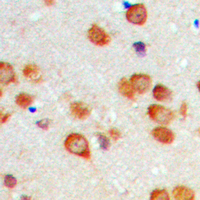 19 - Anti-Cytochrome P450 2C19 Antibody AP60448
