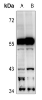 1 - Anti-Cytochrome P450 2C19 Antibody AP60448