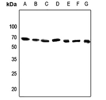 1 - Anti-DDX52 Antibody AP60450