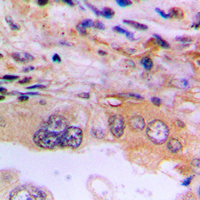 19 - Anti-EEF2K Antibody [KO/KD Validated] AP60452