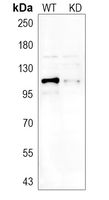 0 - Anti-EEF2K Antibody [KO/KD Validated] AP60452