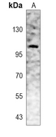 1 - Anti-EEF2K Antibody [KO/KD Validated] AP60452