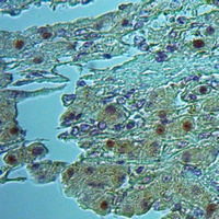 19 - Anti-EIF3K Antibody AP60454