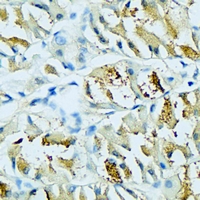 19 - Anti-EIF4E3 Antibody AP60455