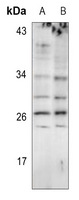 1 - Anti-EIF4E3 Antibody AP60455