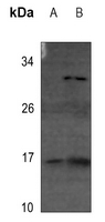 1 - Anti-4EBP1 (Phospho-T69) Antibody AP60456