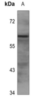1 - Anti-EPN2 Antibody AP60457