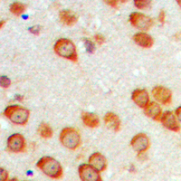 19 - Anti-EPN3 Antibody AP60458