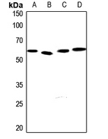 1 - Anti-EPN3 Antibody AP60458
