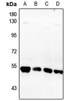 1 - Anti-Fibulin 5 Antibody AP60461