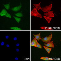3 - Anti-FTH1 Antibody AP60462