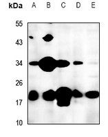 1 - Anti-FTH1 Antibody AP60462