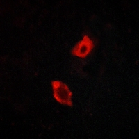 3 - Anti-GPR158 Antibody AP60463
