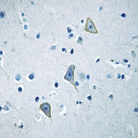 19 - Anti-GPR158 Antibody AP60463
