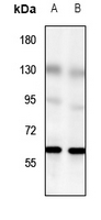 1 - Anti-GPR56 Antibody AP60464
