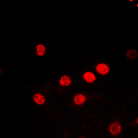 3 - Anti-Histone H2B (Acetyl-K5) Antibody AP60466