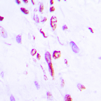 19 - Anti-Histone H2B (Acetyl-K5) Antibody AP60466