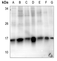 1 - Anti-Histone H2B (Acetyl-K5) Antibody AP60466