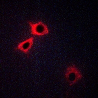 3 - Anti-5-HT1F Antibody AP60467