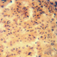 19 - Anti-5-HT1F Antibody AP60467