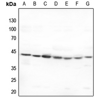 1 - Anti-5-HT1F Antibody AP60467