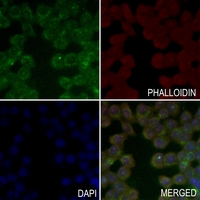 3 - Anti-CD213a2 Antibody AP60468