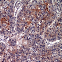 19 - Anti-CD213a2 Antibody AP60468