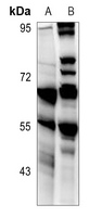 1 - Anti-CD213a2 Antibody AP60468