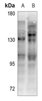 1 - Anti-CD130 Antibody AP60469