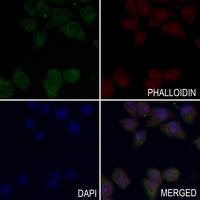 3 - Anti-Insulin Receptor (Phospho-Y1355) Antibody AP60470