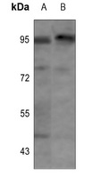 1 - Anti-Insulin Receptor (Phospho-Y1355) Antibody AP60470