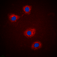 3 - Anti-IRS1 (Phospho-S307) Antibody AP60471
