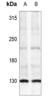 1 - Anti-IRS1 (Phospho-S307) Antibody AP60471