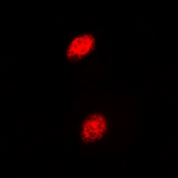 3 - Anti-Islet-2 Antibody AP60472