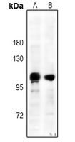 1 - Anti-CD61 (Phospho-Y785) Antibody AP60473