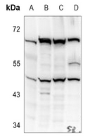 1 - Anti-Kir2.1 Antibody AP60474