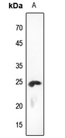 1 - Anti-KDELR2 Antibody AP60475