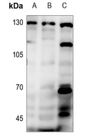 1 - Anti-PRKD1/2/3 (Phospho-S738/S742) Antibody AP60476