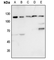 1 - Anti-KSR1 Antibody AP60477