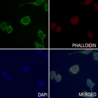 3 - Anti-Laminin gamma 3 Antibody AP60478