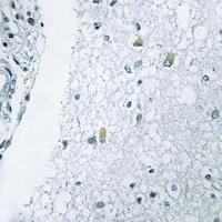 19 - Anti-Laminin gamma 3 Antibody AP60478
