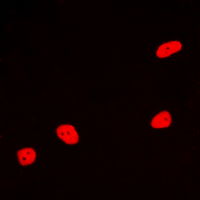 3 - Anti-MEF2A Antibody AP60480