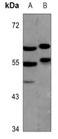 1 - Anti-MEF2A Antibody AP60480