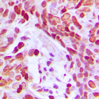 19 - Anti-MEF2D (Phospho-S444) Antibody AP60481