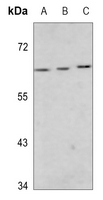 1 - Anti-MEF2D (Phospho-S444) Antibody AP60481