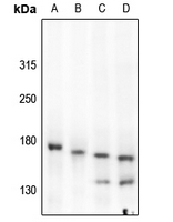 1 - Anti-c-Met (Phospho-Y1349) Antibody AP60482
