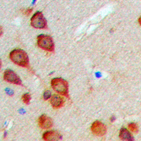 19 - Anti-MEKKK6 Antibody AP60483