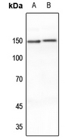 1 - Anti-MEKKK6 Antibody AP60483